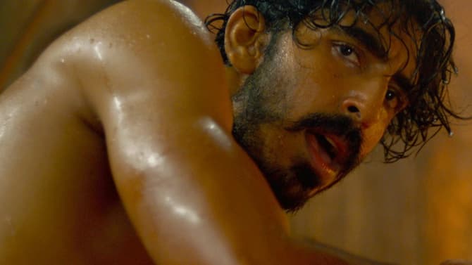 MONKEY MAN Star And Director Dev Patel Shares How He Broke His Hand On The First Day Of Filming
